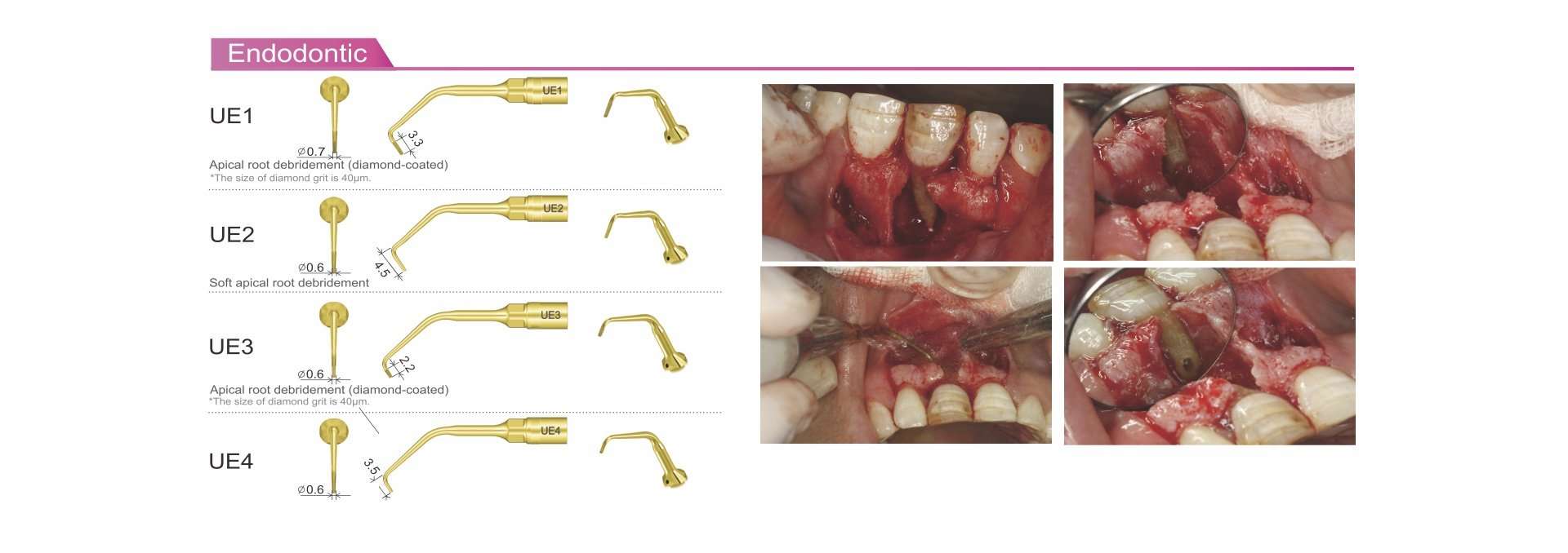 Piezo Surgery SURGIC TOUCH LED Woodpecker - Imagen 5