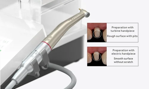 MT3 Micromotor eléctrico de sobremesa Woodpecker - Casadental 4 (2)
