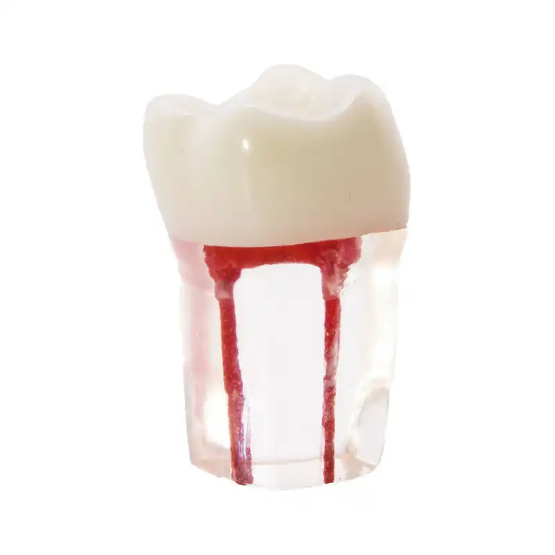 Molar con Conductos Radiculares Bader
