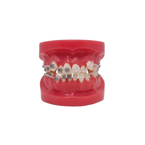 Modelo de Bracket Metálico y zafiro Bader